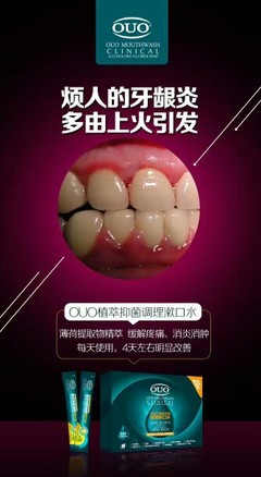 口腔細(xì)菌 不只是口腔問(wèn)題，更是全身健康的隱形殺手